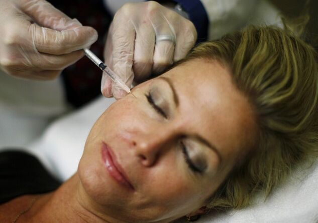 La introducción de rellenos en la piel del rostro es un método de inyección para tensar
