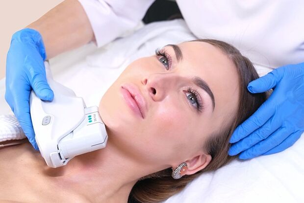 Lifting facial de hardware con el fin de una regeneración efectiva de la piel. 