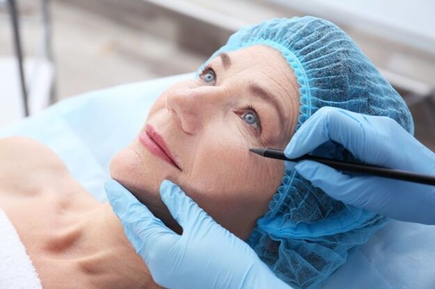 Preparación para un procedimiento de estiramiento facial no quirúrgico