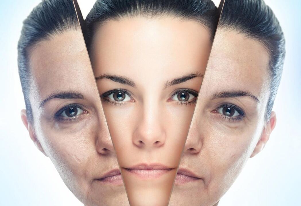 metodos de rejuvenecimiento facial