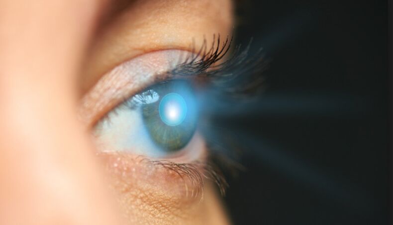 rejuvenecimiento de la piel alrededor de los ojos con láser